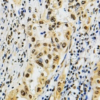 POLR3B Antibody