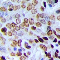Anti-POLR3E Antibody