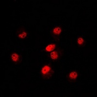 Anti-POLR3E Antibody
