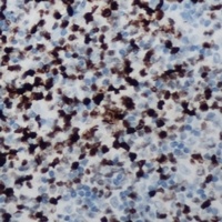 Anti-CCNB1IP1 Antibody
