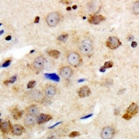 Anti-GABRG1 Antibody