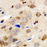 GABRG1 antibody