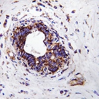 Anti-GGH Antibody