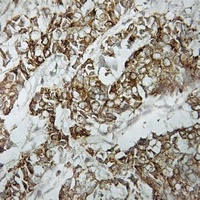 Anti-HLA-DOA Antibody