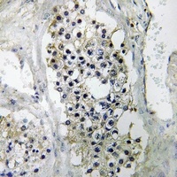 Anti-LIPI Antibody