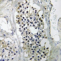 LIPI antibody