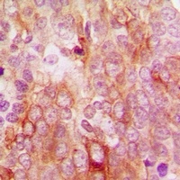 Anti-MCT12 Antibody