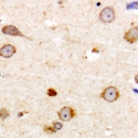 Anti-ME3 Antibody
