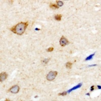 Anti-NBPF5 Antibody
