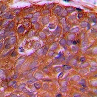 Anti-PEX2 Antibody