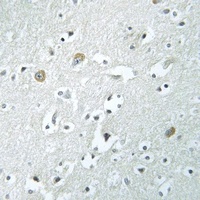 Anti-PLA1A Antibody