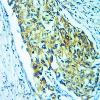 Anti-HCN2 Antibody