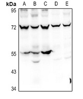Prosaposin Antibody