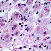 Anti-NDRG4 Antibody