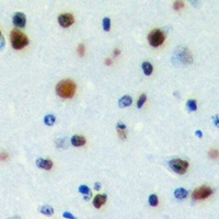 Anti-PWWP2B Antibody