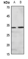 PRKY Antibody