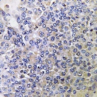 Anti-PPP4R2 Antibody
