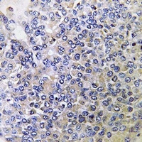 PPP4R2 antibody