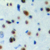 Anti-SESN1 Antibody