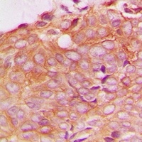Anti-SPTBN1 Antibody
