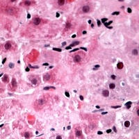 Anti-TIGD3 Antibody