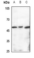 TBL2 Rabbit Polyclonal Antibody