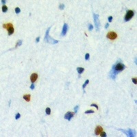 TBL2 Rabbit Polyclonal Antibody