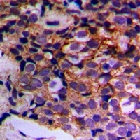 Anti-MTIF3 Antibody