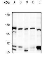 UBE3B Antibody