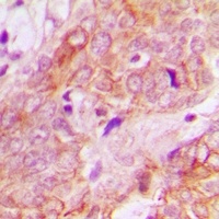 Anti-UBE3B Antibody