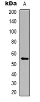 Cytochrome P450 21A2 Rabbit Polyclonal Antibody