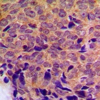Anti-Cytochrome P450 21A2 Antibody