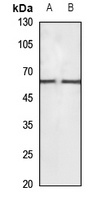 CaMKK beta Rabbit Polyclonal Antibody