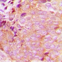CaMKK beta Rabbit Polyclonal Antibody