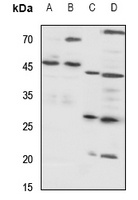 Cathepsin D Rabbit Polyclonal Antibody