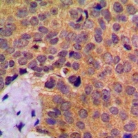 Anti-Cathepsin D Antibody