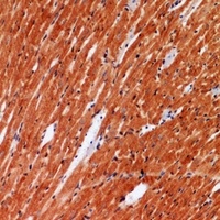 Anti-ANGPTL1 Antibody
