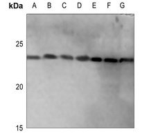 IFN alpha 1 Antibody