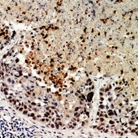 BCAT1 antibody