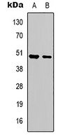 Serpin A1 Rabbit Polyclonal Antibody