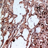 Serpin A1 Rabbit Polyclonal Antibody