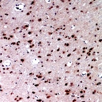 Anti-Layilin Antibody