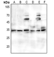 PORIN Rabbit Polyclonal Antibody