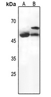 Serpin A3 Antibody