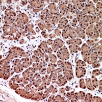 SERPINA3 antibody