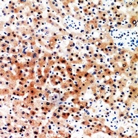 CD7 antibody