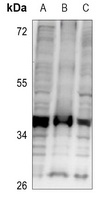 CD74 Antibody