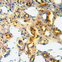 Anti-CD316 Antibody