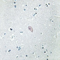 Anti-Beta-2 Adrenergic Receptor Antibody
