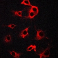 Anti-Beta-2 Adrenergic Receptor Antibody